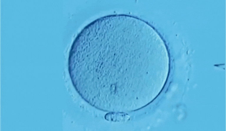 ICSI