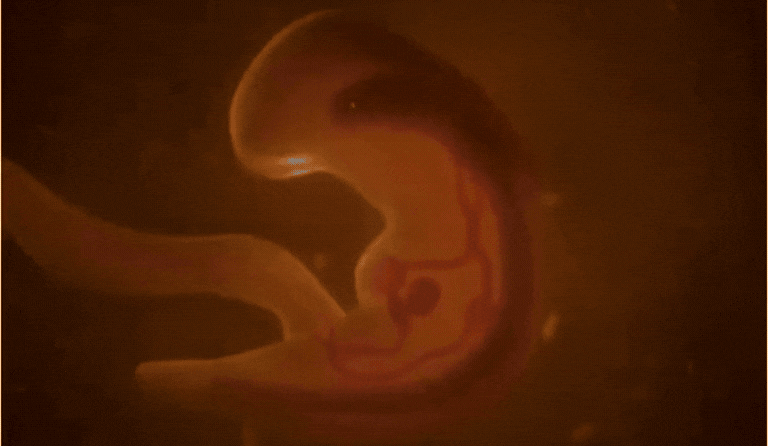 IVF